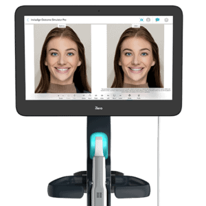 Invisalign Outcome Simulator