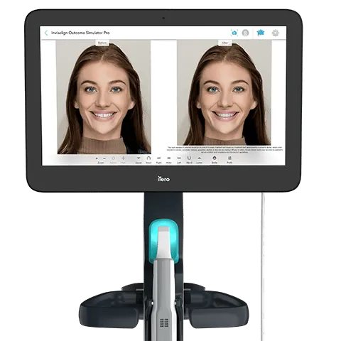 Invisalign Outcome Simulator